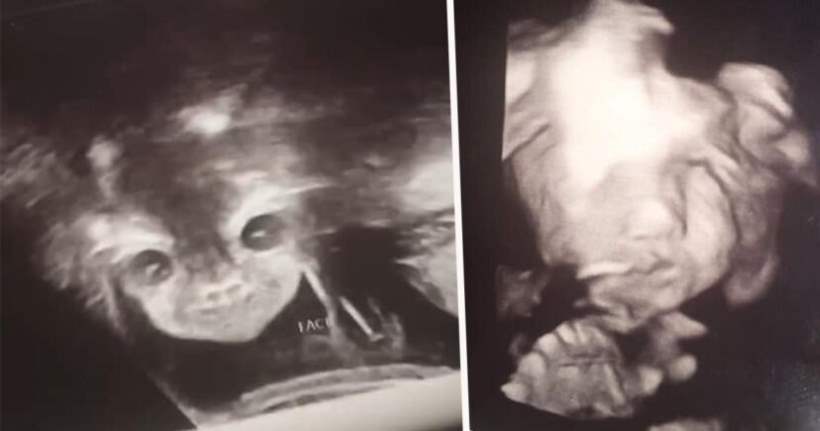 Девочка-подросток из Вирджинии вынашивает ребенка инопланетян?