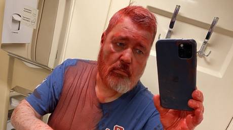 Лауреата Нобелевской премии мира облили краской — RT Россия и страны бывшего СССР