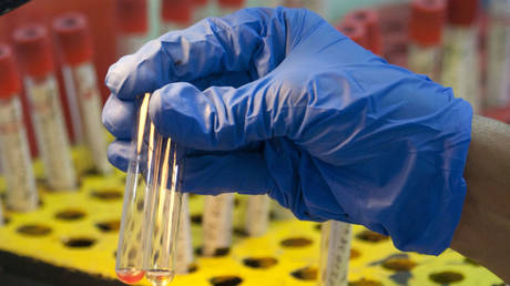 Испания бьет тревогу из-за загадочного гепатита у детей — RT World News