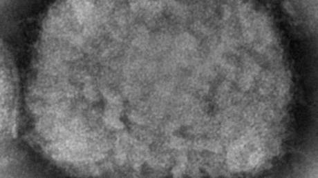 Центры по контролю и профилактике заболеваний говорят о двух отдельных вспышках, вызывающих случаи оспы обезьян — RT World News