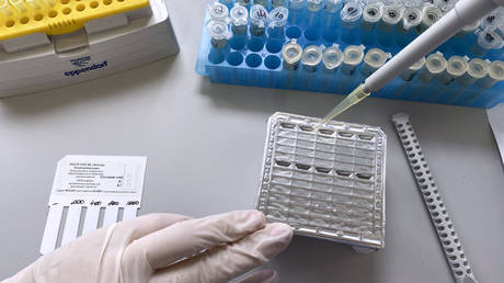 Российский наблюдатель высказался о распространении оспы обезьян — пресс-релизы RT