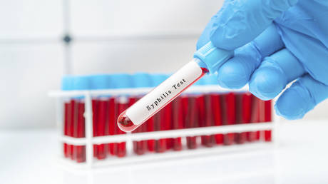 Заболевания, передающиеся половым путем, в США «вышли из-под контроля» — чиновники — RT World News