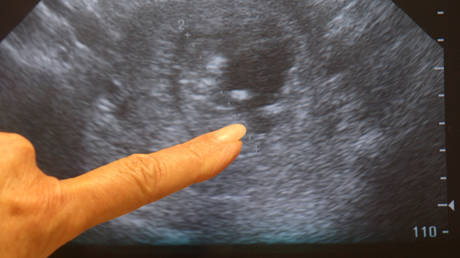 Russia to debate church’s radical new abortion proposal — RT Russia & Former Soviet Union