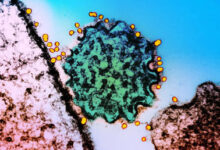 Вспышка вируса Нипах в Индии вызывает беспокойство в азиатских странах