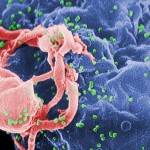 ВИЧ больше не является смертельным заболеванием — Ученые