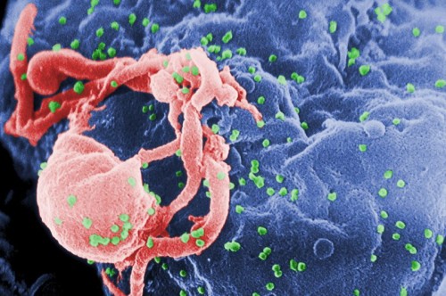 ВИЧ больше не является смертельным заболеванием — Ученые
