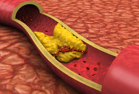 Мед. сотрудники доказали безвредность холестерина для сердца человека