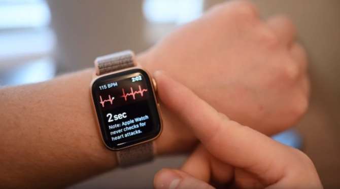 ЭКГ в Apple Watch в первый раз спасла жизнь человека