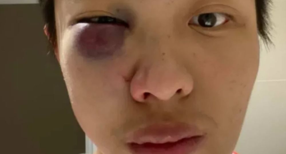 Мальчика из Великобритании осудили за то, что он ударил сингапурца и кричал, что не хочет ‘ваш гребаный коронавирус’