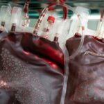 Женщина победила ВИЧ с помощью нового лечения — RT World News