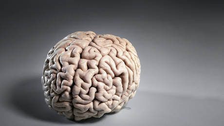 Covid может вызвать сокращение мозга, говорится в исследовании