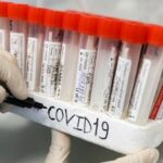 В Ростовской области зафиксировали 1008 случаев COVID-19 за сутки — РТ на русском