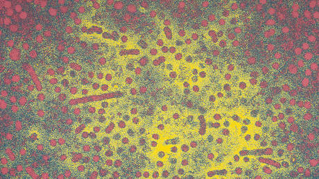 Центры по контролю и профилактике заболеваний США расследуют волну случаев гепатита у детей