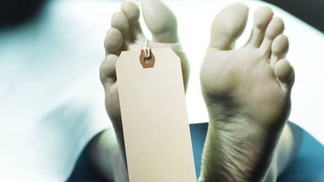Владелец похоронного бюро в США признал себя виновным в продаже частей тела за наличные