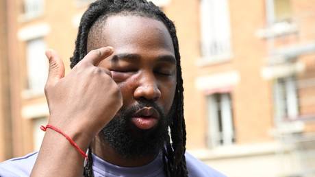 Французский активист против полицейских заявляет о жестокости полиции
