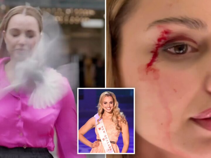 Журналистка из Новой Зеландии получила шрам в прямом эфире после столкновения с чайкой