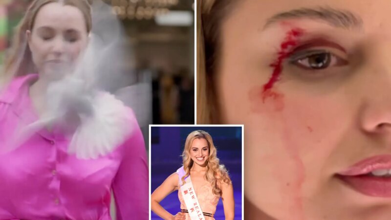 Журналистка из Новой Зеландии получила шрам в прямом эфире после столкновения с чайкой