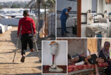 Осколки жизни: тысячи ампутированных в Газе ждут помощи, чтобы снова встать на ноги