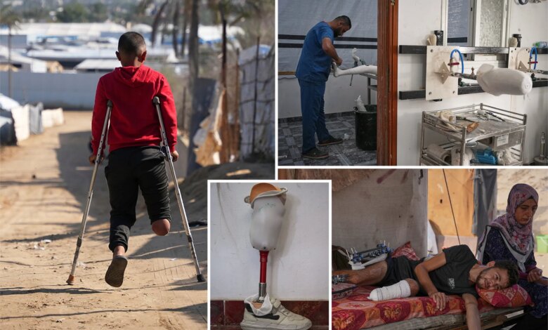 Осколки жизни: тысячи ампутированных в Газе ждут помощи, чтобы снова встать на ноги