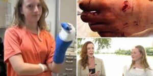 «Я не злюсь на океан, только немного на Сьюзи»: 13-летняя американка пережила атаку барракуды и дала рыбе имя