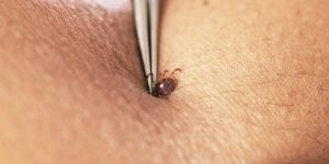 Вирус Бурбон добрался до Нью-Йорка: первый случай редкой клещевой инфекции, против которой нет ни вакцины, ни лекарства